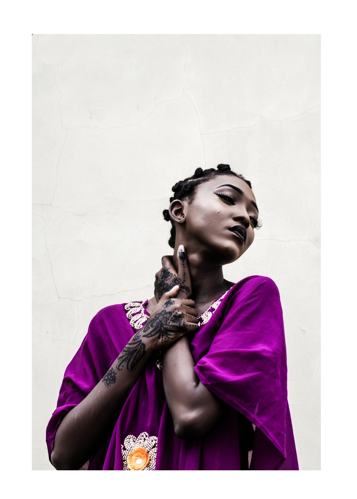 Social Anxiety Disorder